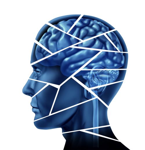 Brain Injury Artistic Representation